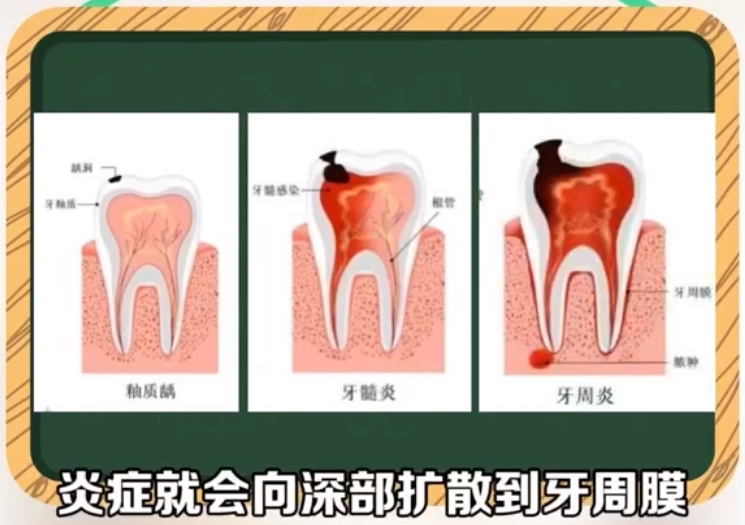 牙周健康知多少